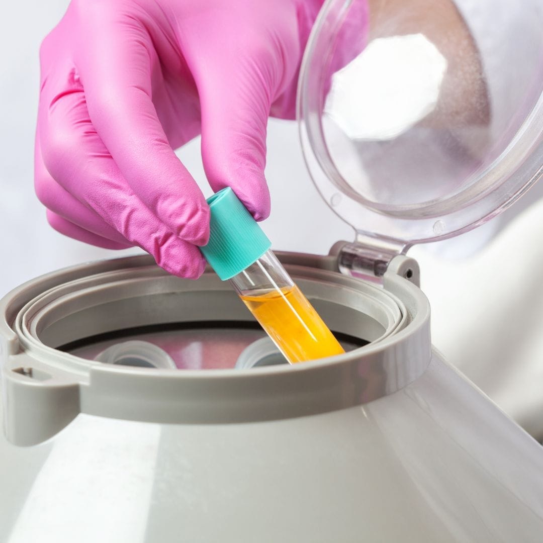 How Does PRP Work? The Complete Guide